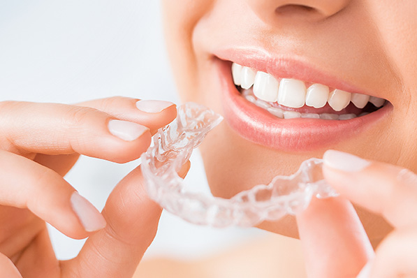 マウスピース型（カスタムメイド）矯正（歯科）装置（シュアスマイル）