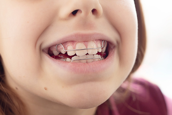 保定・経過観察