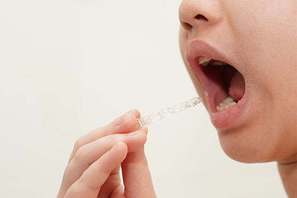 マウスピース型矯正装置